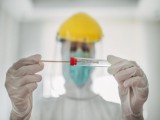 Lebih Beresiko, Varian Baru Virus SARS-CoV-2 Ditemukan di Indonesia