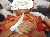 Menyeberang ke Sekolah, Anak SD Tewas Ditabrak Mobil