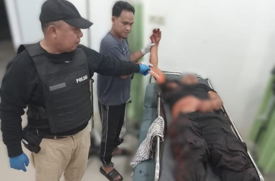 Polisi memeriksa luka di tubuh korban