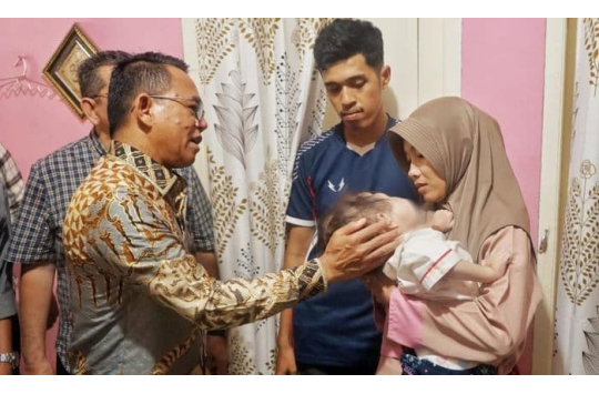 Wakil Wali Kota Medan, Zakiyuddin Harahap, menyambangi rumah Mikhayla di Medan Labuhan sambil menyerahkan bantuan dan memastikan proses rujukan medis berjalan lancar.(foto: Diskominfo Medan)