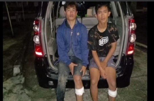 Bekas tembakan di kaki ersangka